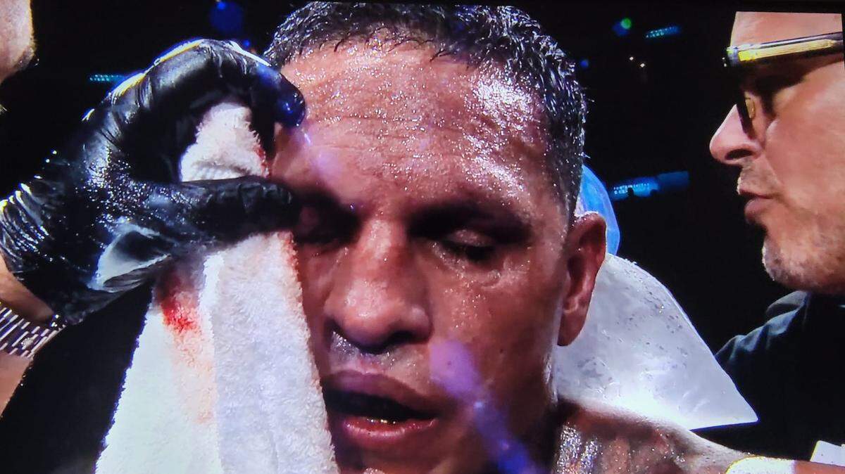Ulysses Díaz sufrió una herida en el ojo, pero eso no impidió que tuviera una pelea entretenida en Sunrise., Florida.