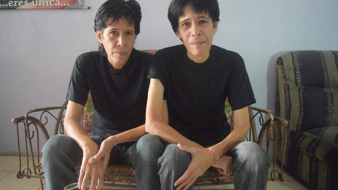 Lamski y Tatsienlu Pérez, en Valencia, Venezuela, dicen que han perdido 77 libras cada una desde el colapso de la economía en el 2015.