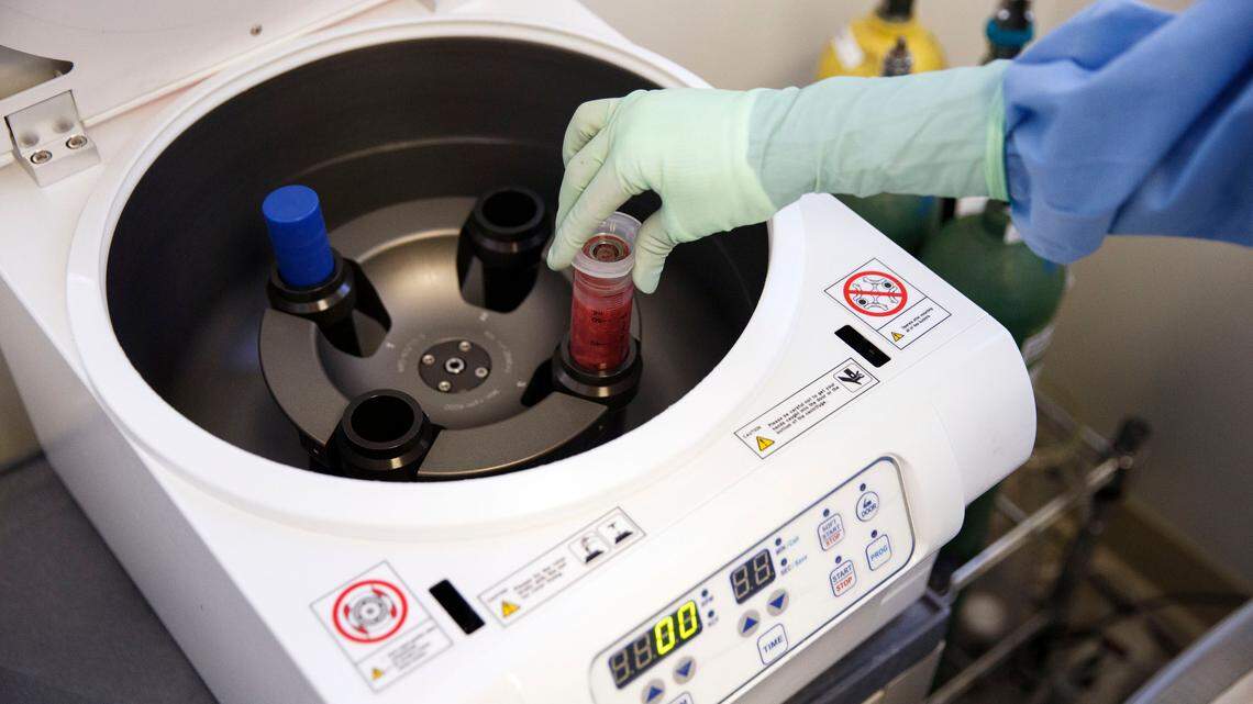 Stem cells are isolated from fat tissue using a centrifuge machine such as the one pictured here.