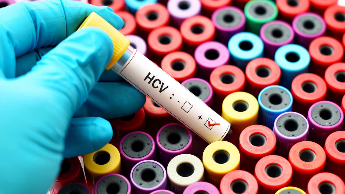 Panel federal en EEUU recomienda dejar de vacunar a recién nacidos contra la hepatitis B