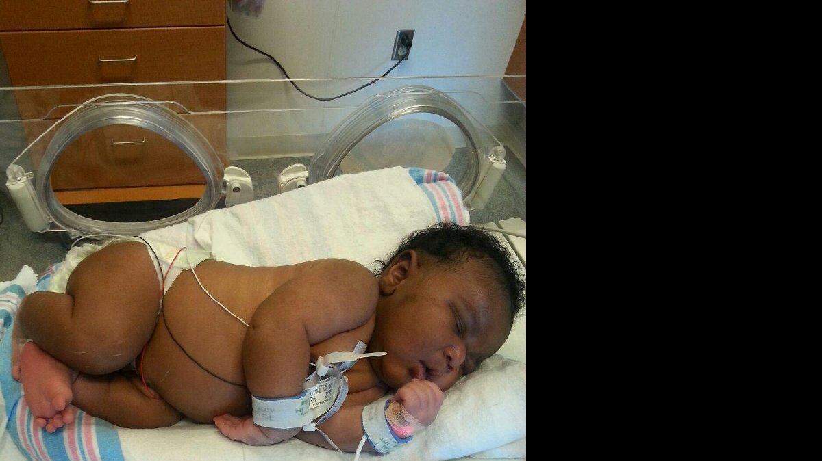 Esta foto proporcionada por Womens Hospital de San José muestra Avery Denton, el bebé de 14.1 libras nacido en el hospital en Tampa el 29 de enero de 2015. El hospital dice que el niño es el más pesado nacido en el hospital, y uno de los más grandes nacido en el estado. Después de 18 horas de parto, nació Avery, quien permanece en cuidados intensivos neonatal, pero se espera que vaya azada pronto.
