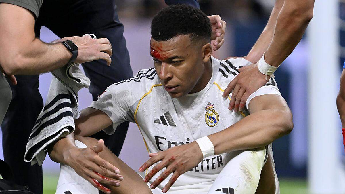 El delantero del Real Madrid, Kylian Mbappé, no se entrenó este domingo junto al resto del grupo por precaución después de recibir puntos en su ceja derecha a causa del golpe que recibió durante el partido ante el Girona.