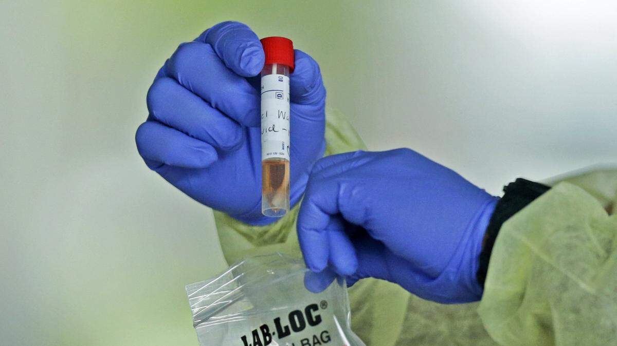 Un trabajador de la salud de American Medical Response sostiene una prueba de COVID-19 en el centro de pruebas de Holiday Park, ubicado en el 1150 G. Harold Martin Drive, en Fort Lauderdale, el jueves 30 de abril de 2020.