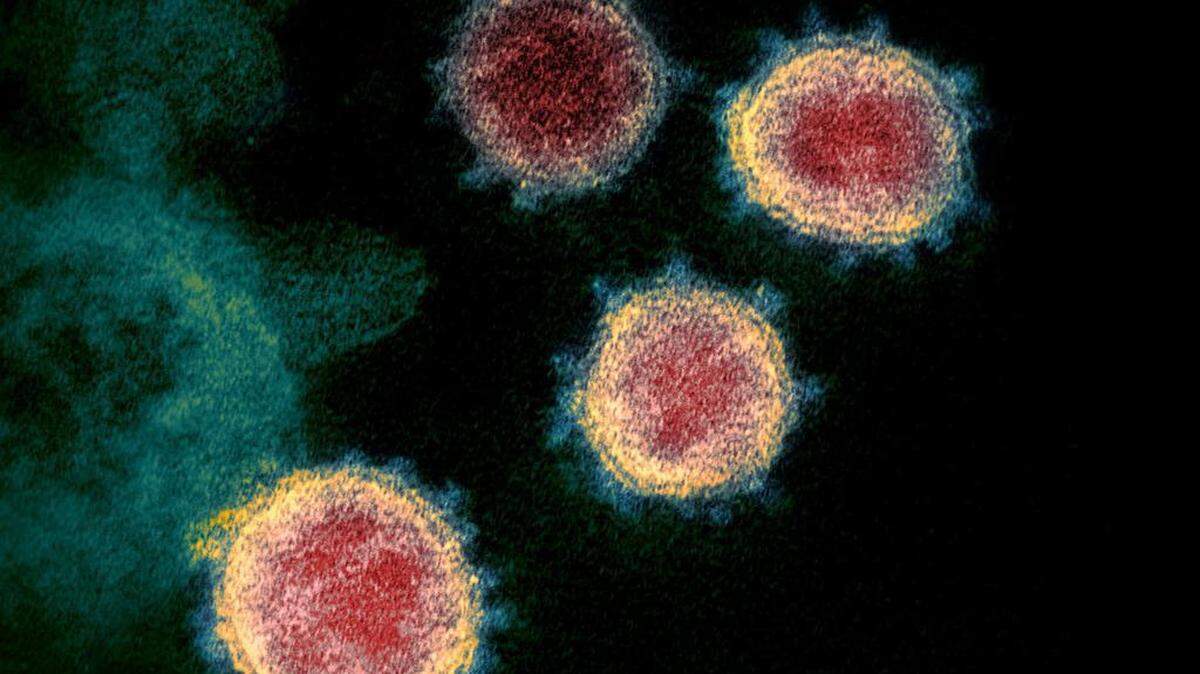 Illustration obtained on February 27, 2020 courtesy of the National Institutes of Health shows a transmission electron microscope image showing the coronavirus.