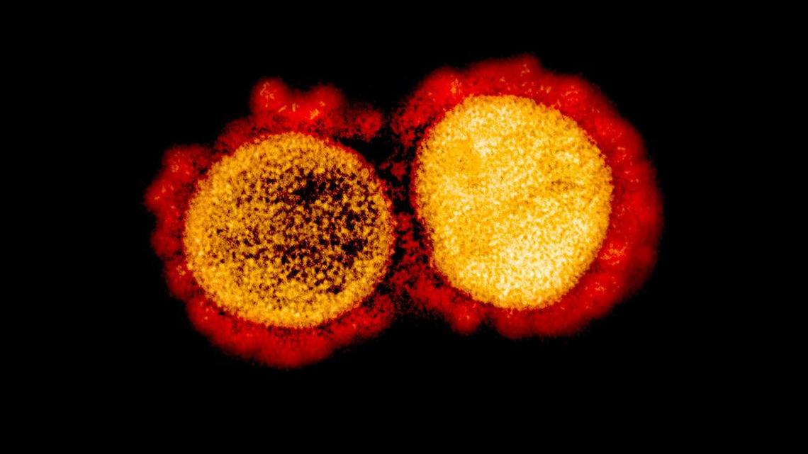 This image, courtesy of the National Institute of Allergy and Infectious Diseases (NIH / NIAID), shows a transmission electron micrograph of SARS-CoV-2 virus particles, isolated from a patient, captured and color enhanced at the Integrated Research Facility ( IRF) from the NIAID at Fort Detrick, Maryland.