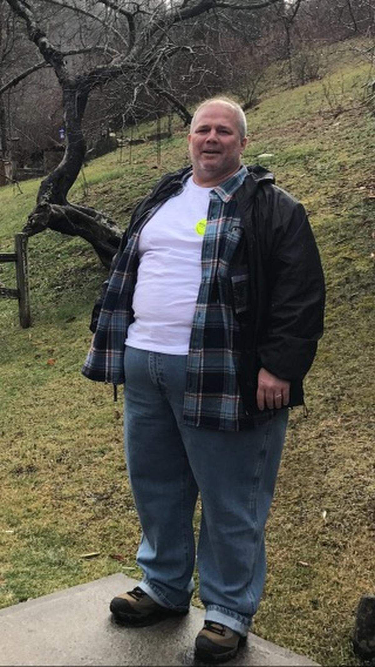 Mario Farnesi cuando pesaba 392 libras, antes de optar por la cirugía bariátrica en el Jackson Memorial Hospital. Luego de la cirugía Farnesi ha perdido más de 150 libras.