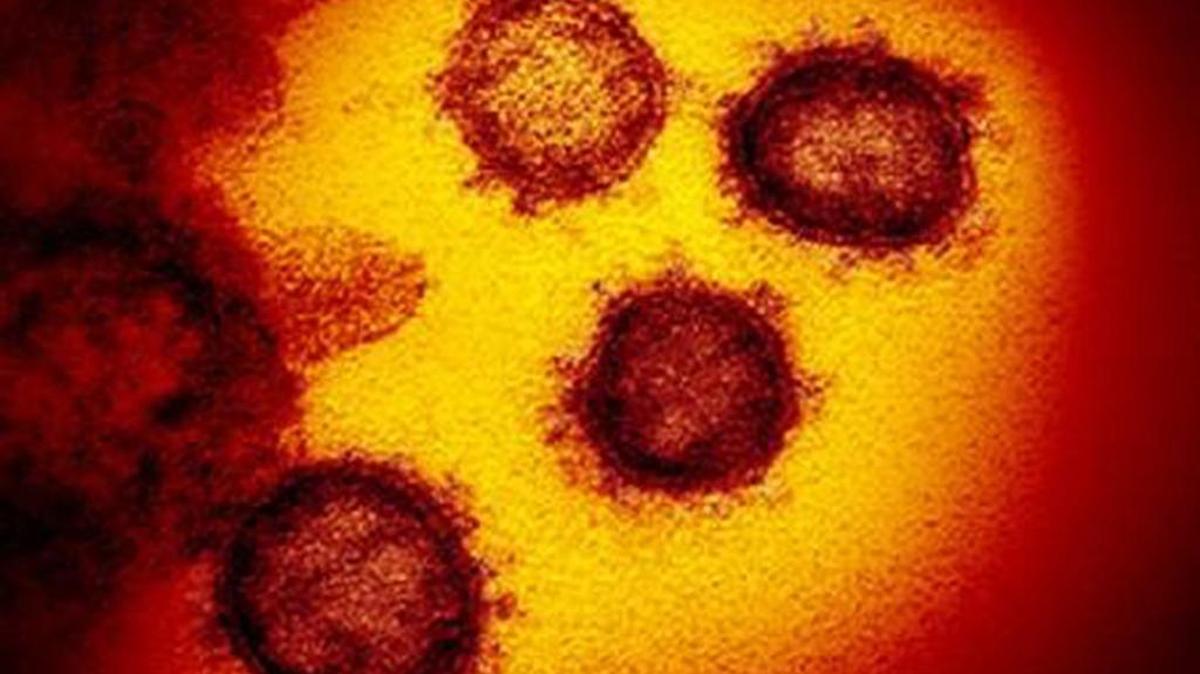 Esta imagen de microscopio electrónico muestra SARS-CoV-2, el virus que causa COVID-19, aislado de un paciente en los EEUU emergiendo de la superficie de células cultivadas en el laboratorio.