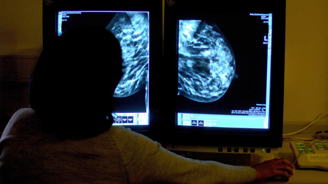 Vacunas contra el cáncer podrían estar en el horizonte, afirman científicos