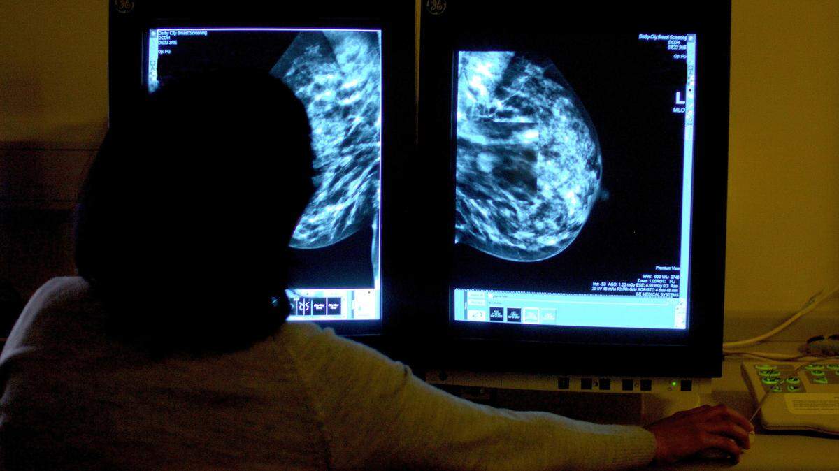 Foto de archivo de una doctora estudiando una mamografía buscando signos de cáncer de mama en sus etapas iniciales.