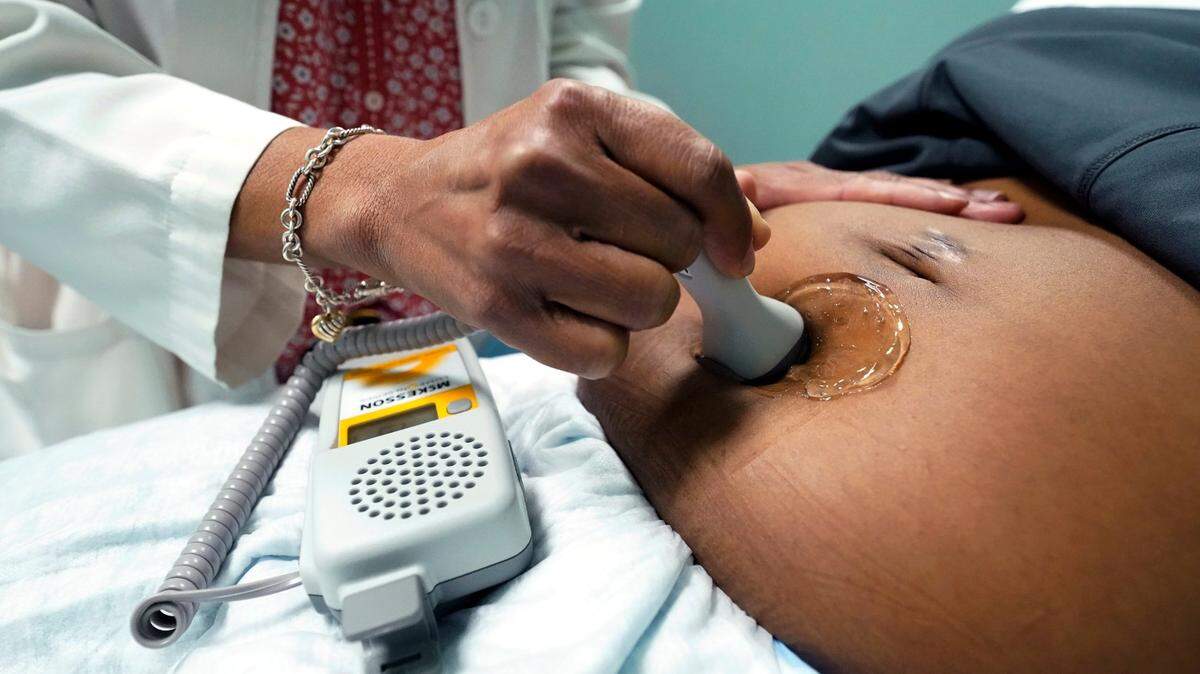 El 53% de las muertes se produjeron mucho después de que fueran dadas de alta del hospital, entre siete días y un año después del parto.