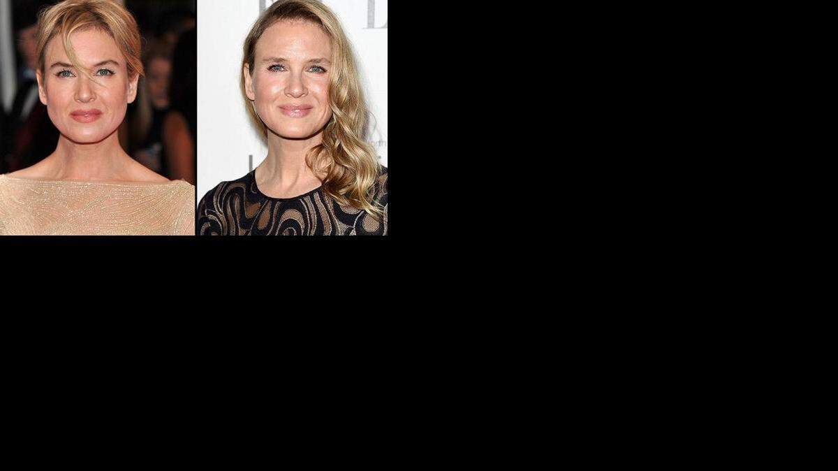 El antes y después de Renée Zellweger.