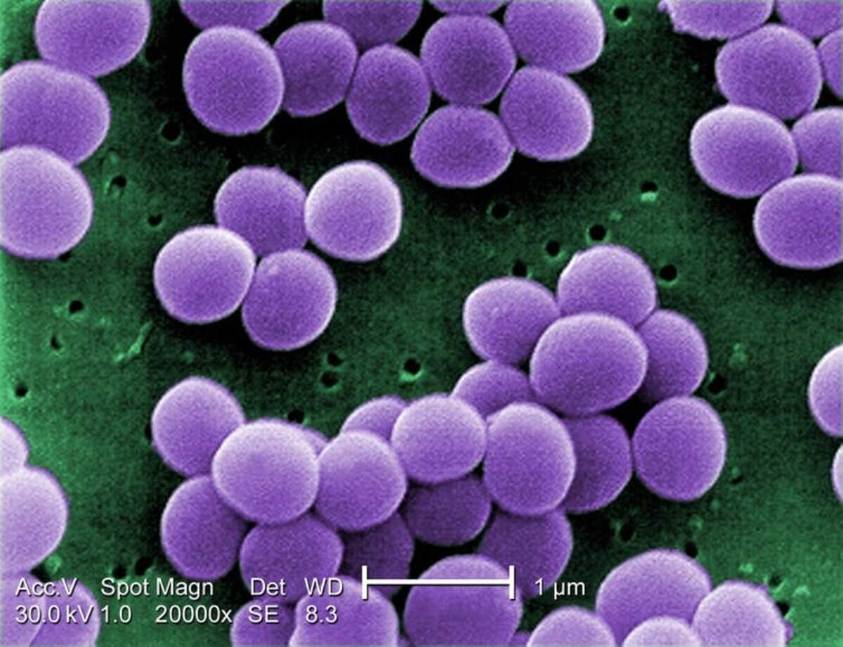 ‘Staphylococcus aureus’, una de las bacterias más comunes de nuestra piel. Wikimedia