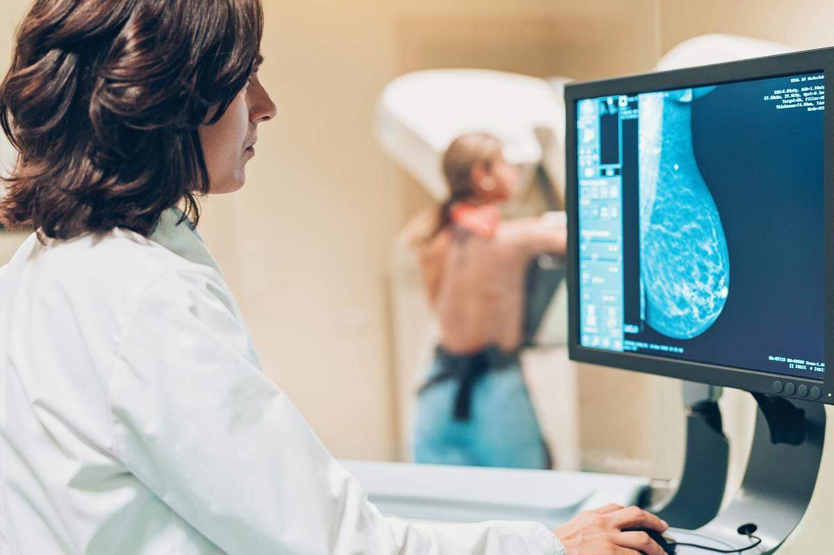 Aunque las radiografías de seno generalmente se utilizan para detectar y diagnosticar cáncer, las imágenes también indican si las arterias de los senos tienen calcificaciones.