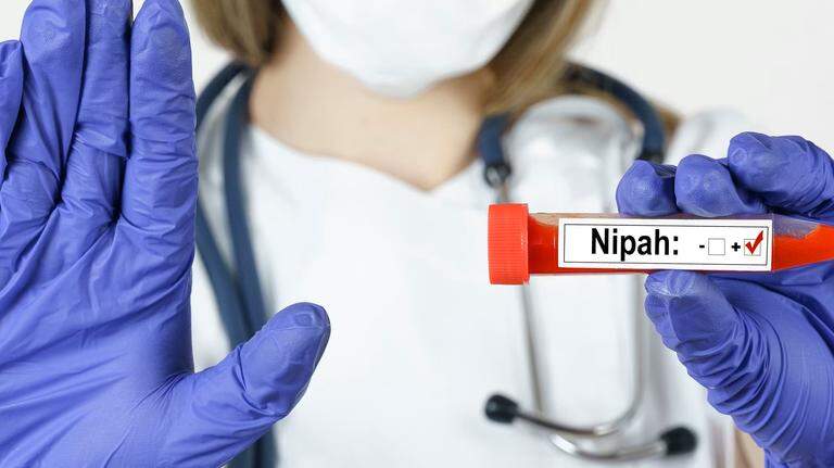 Claves que debemos conocer sobre el peligroso virus Nipah