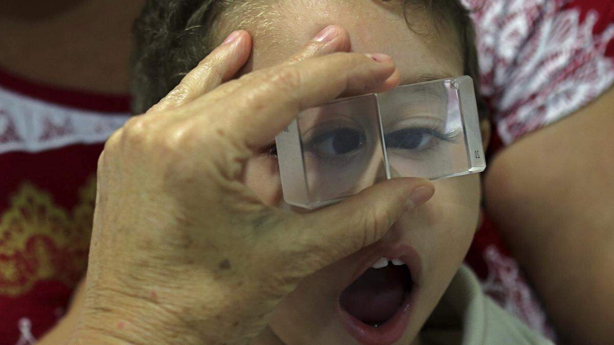 Luiz Mauricio, un niño de dos años que nació con microcefalia debido al contagio con el virus del zika, es examinado por un oftalmólogo en Recife, Brasil, el 8 de mayo del 2018.