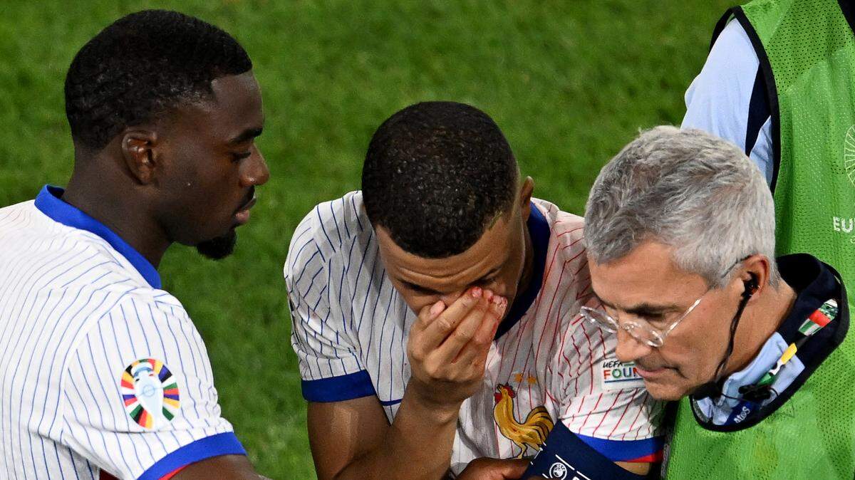 La estrella de la selección francesa Kylian Mbappé se fracturó la nariz durante el primer partido de su selección en la Eurocopa contra Austria, este lunes 17 de junio de 2024 en Dusseldorf, Alemania.