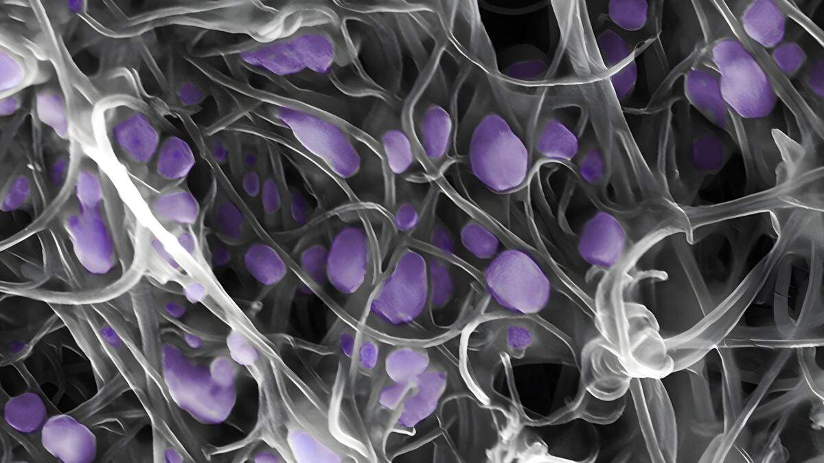 El virus h5n2 atrapado en nanotubos de carbono.