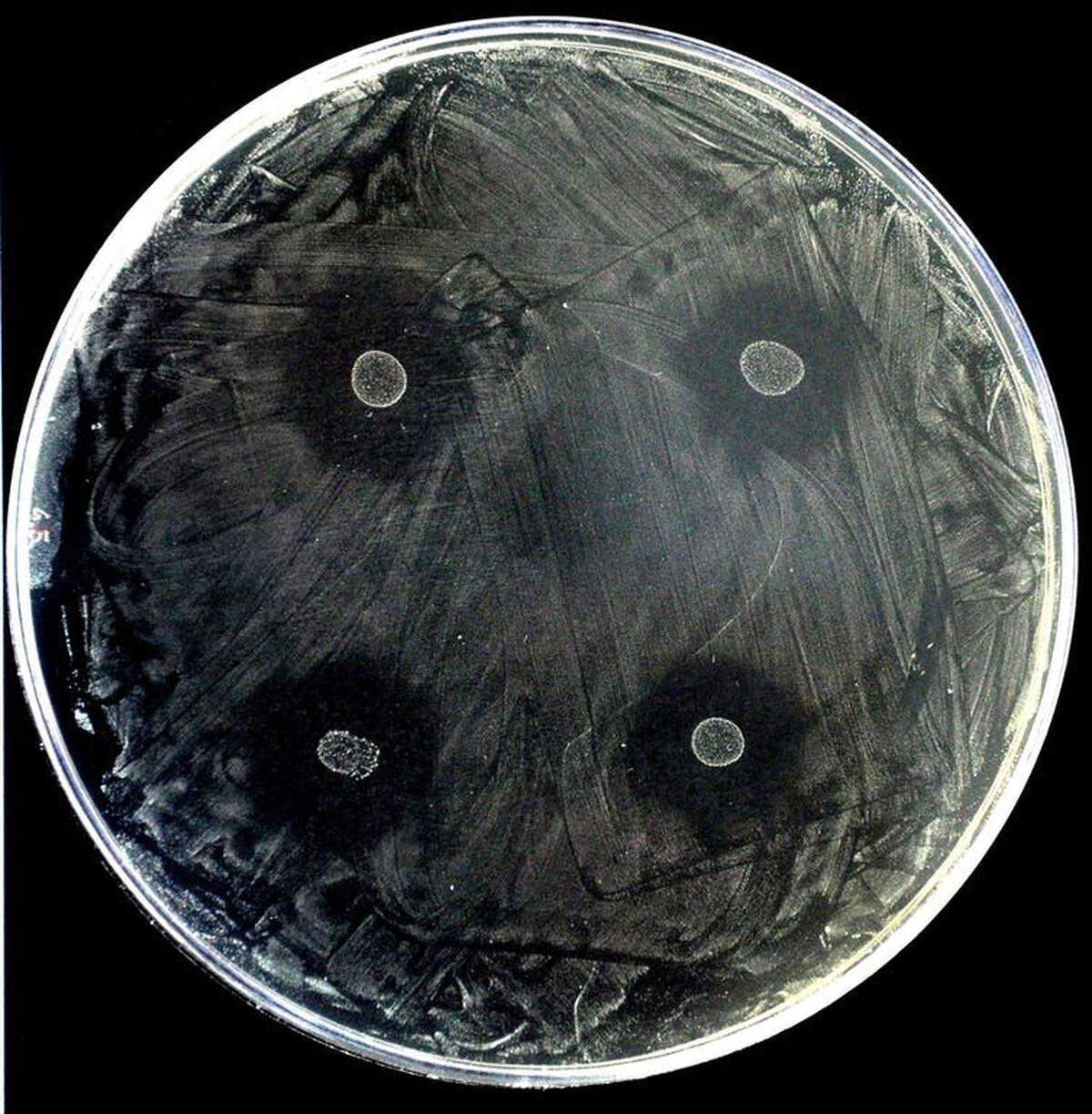 Patógeno de la caries Streptococcus mutans en una placa Petri. Se han cultivado 4 colonias de S. dentisani y se observan halos de inhibición alrededor de las colonias, ya que S. dentisani impide el crecimiento del patógeno. / Luis D. Alcaraz. FISABIO, Author provided