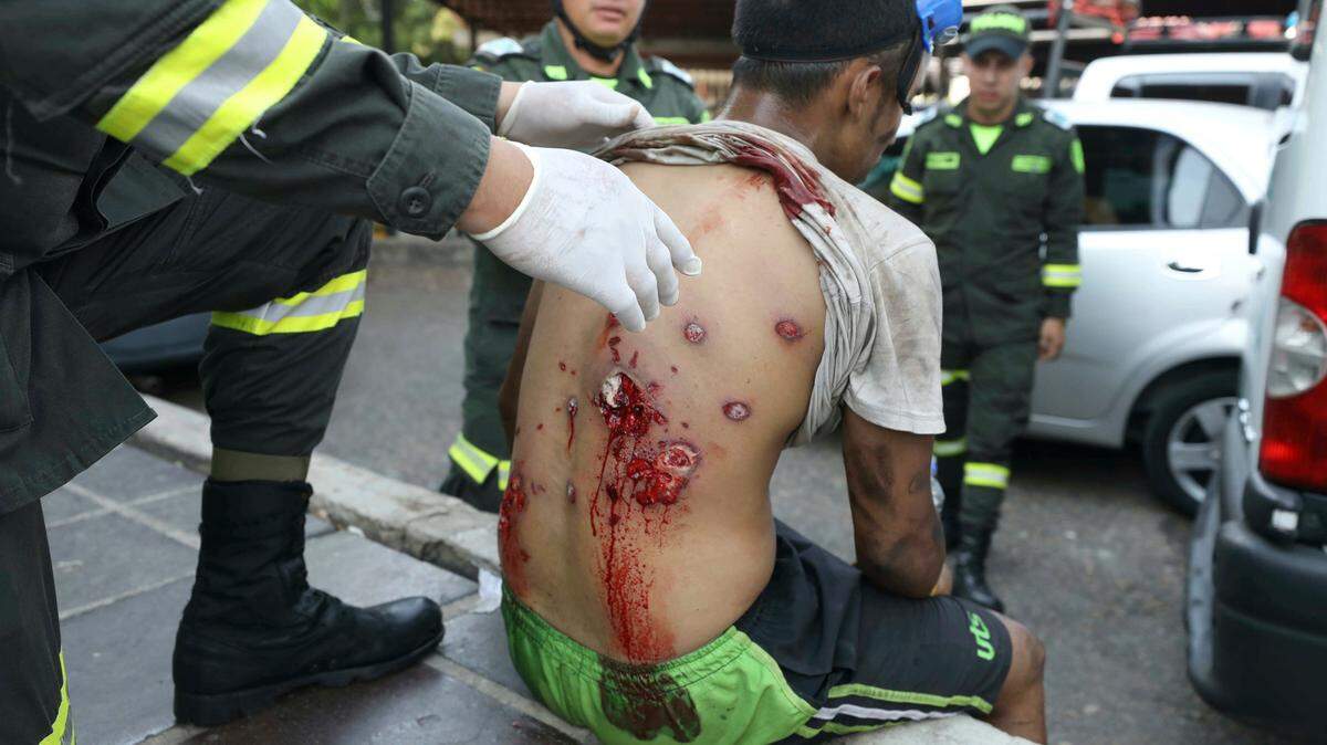 Un médico inspecciona la espalda de un joven que resultó herido el 23 de febrero de 2019 en el Puente Internacional Simón Bolívar, en la frontera entre Venezuela y Colombia, tras el fallido intento de ingresar la ayuda humanitaria a territorio venezolano.