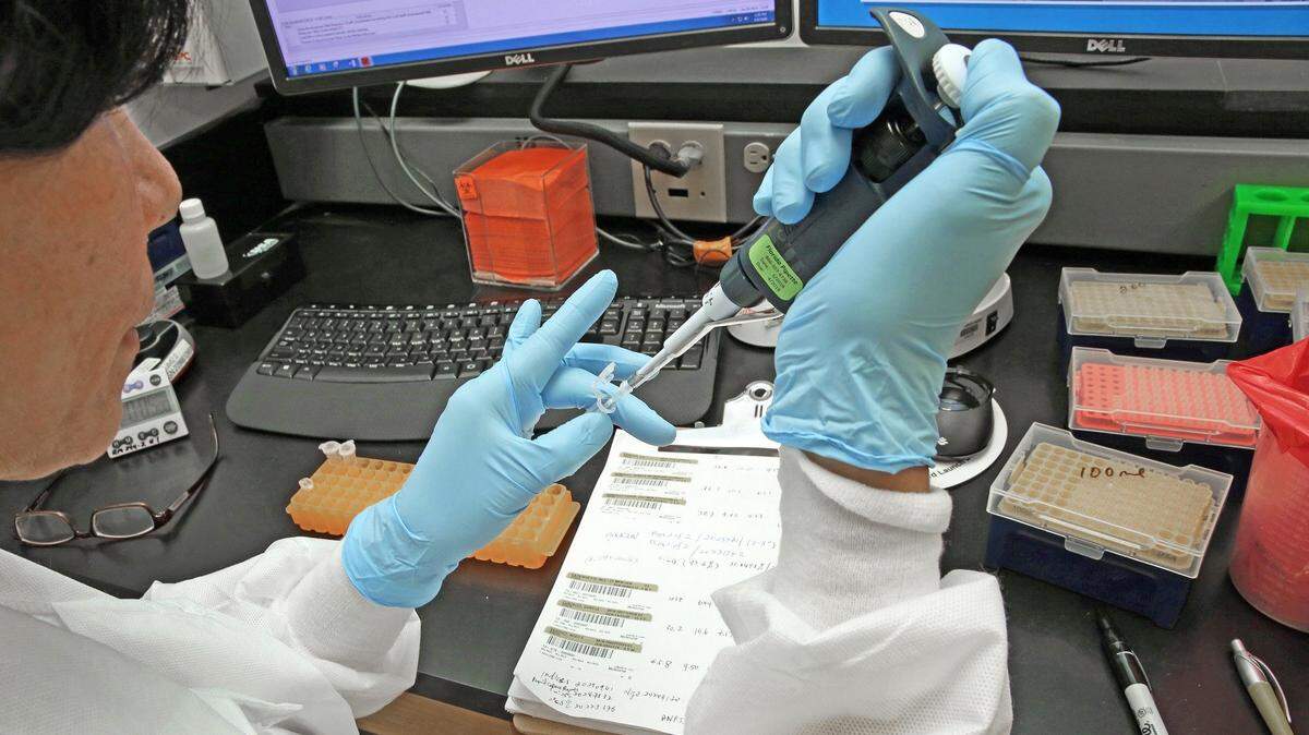 Feiying Ding, técnica en genética molecular en Miami Genetic Laboratories, parte del Nicklaus Children's Hospital, realiza una prueba de ADN.