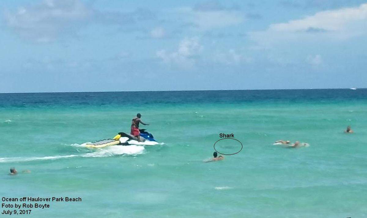Un hombre fue mordido por un tiburón en una playa de Haulover Beach.