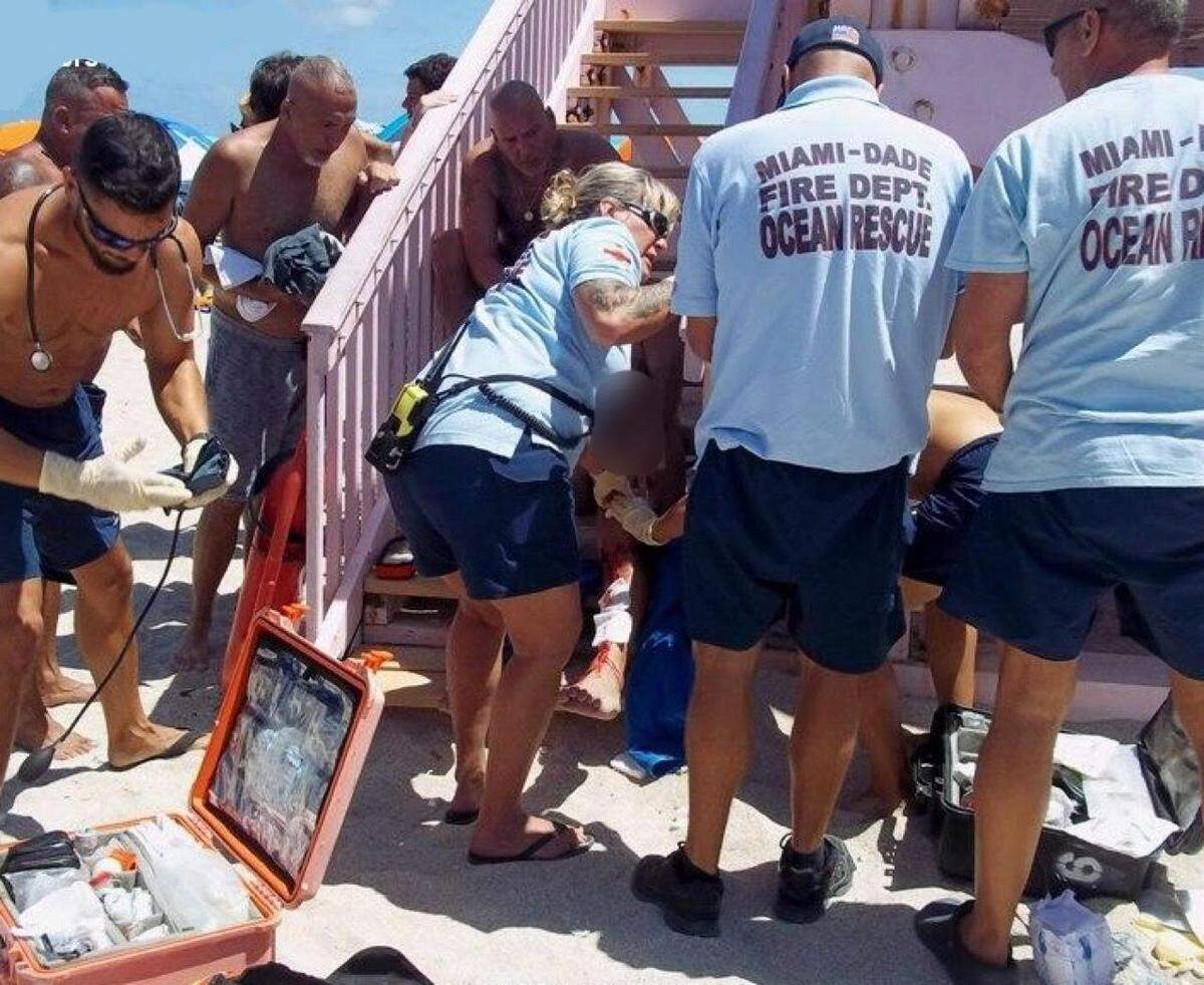 Un hombre fue mordido por un tiburón en una playa de Haulover Beach.