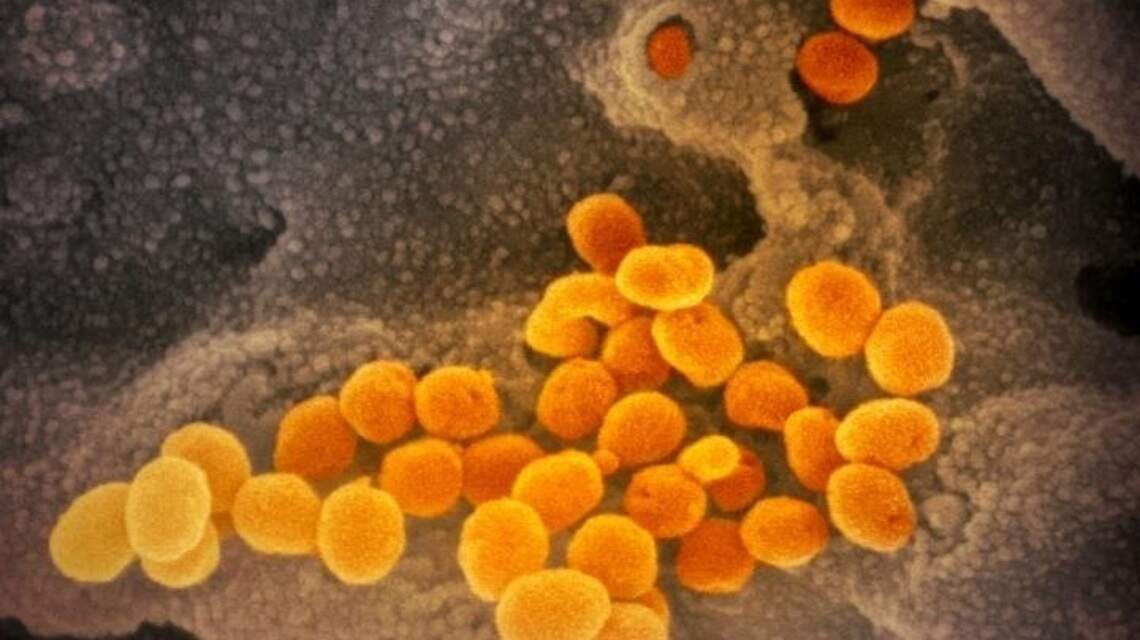 La presencia de un anticuerpo en la sangre puede complicar el covid