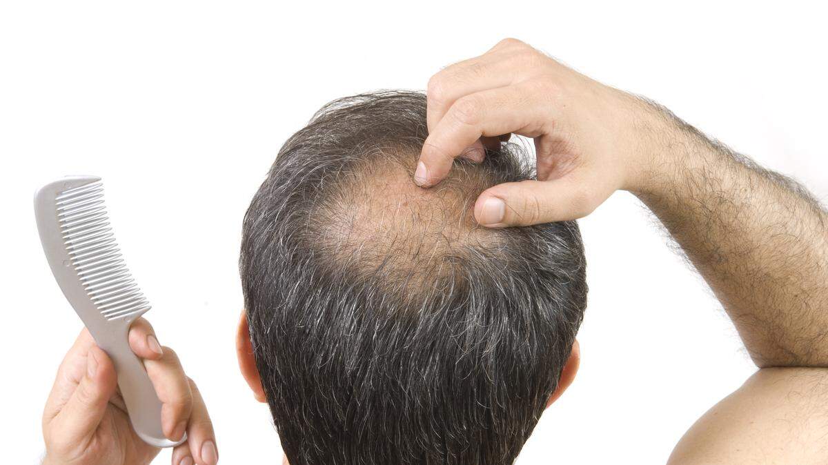 Hair loss, hair thinning may be helped with microneedling with platelet-rich plasma