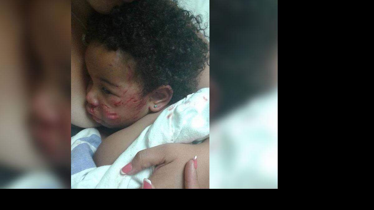 Jaila Lamote, de 15 meses, fue atacada por el perro de un vecino en las afueras de su casa en Miami.   