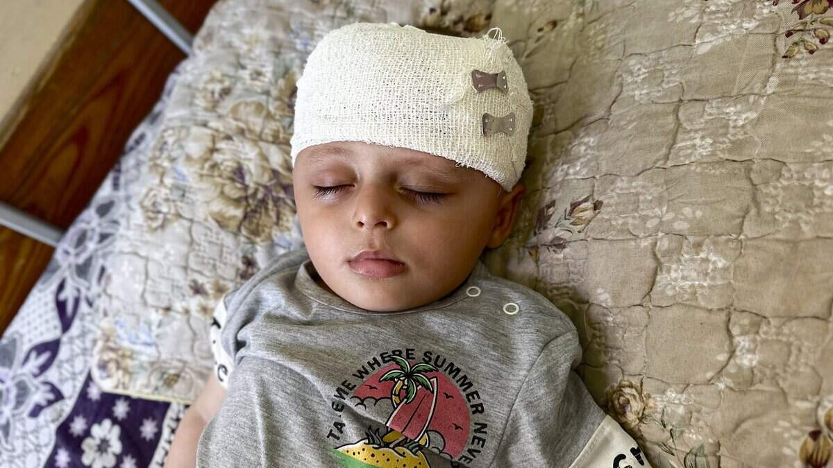 Un niño con la cabeza vendada yace en una cama del Hospital Nasser, en Jan Yunis, Franja de Gaza, el 20 de junio de 2026.