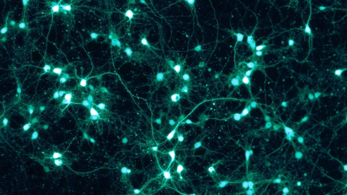 Neuronas marcadas con fluorescencia verde bajo microscopio.