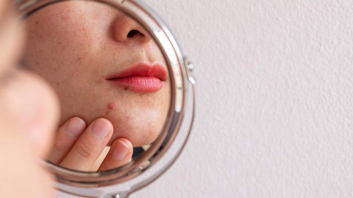 While peptides are safe and rarely cause side effects, they are not the most effective anti-aging skincare ingredients available.