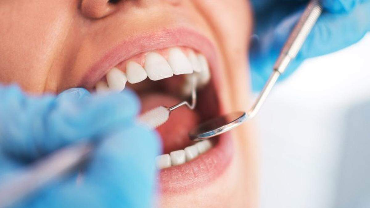 En general, las personas con enfermedades mentales tienen peor salud bucodental, con mayor pérdida de dientes, necesidad de empastes o enfermedad de las encías. 