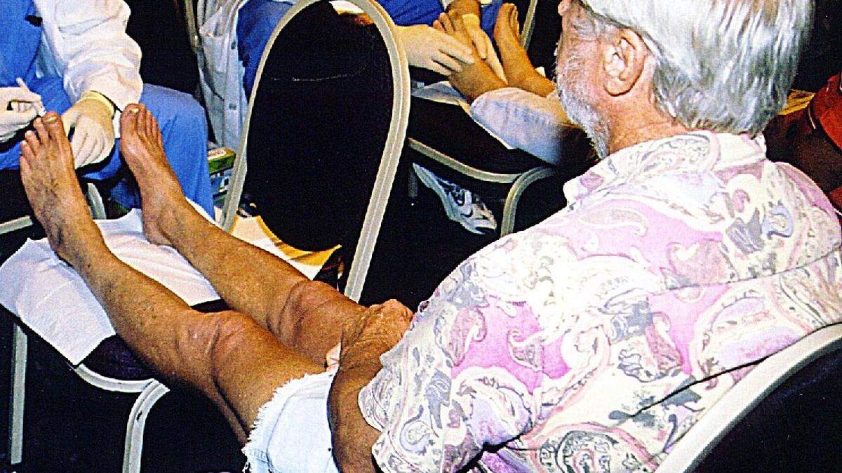La neuropatía diabética causa dolor y, por lo general, el dolor en los diabéticos es diferente al dolor que podemos experimentar con las cefaleas o la artritis.