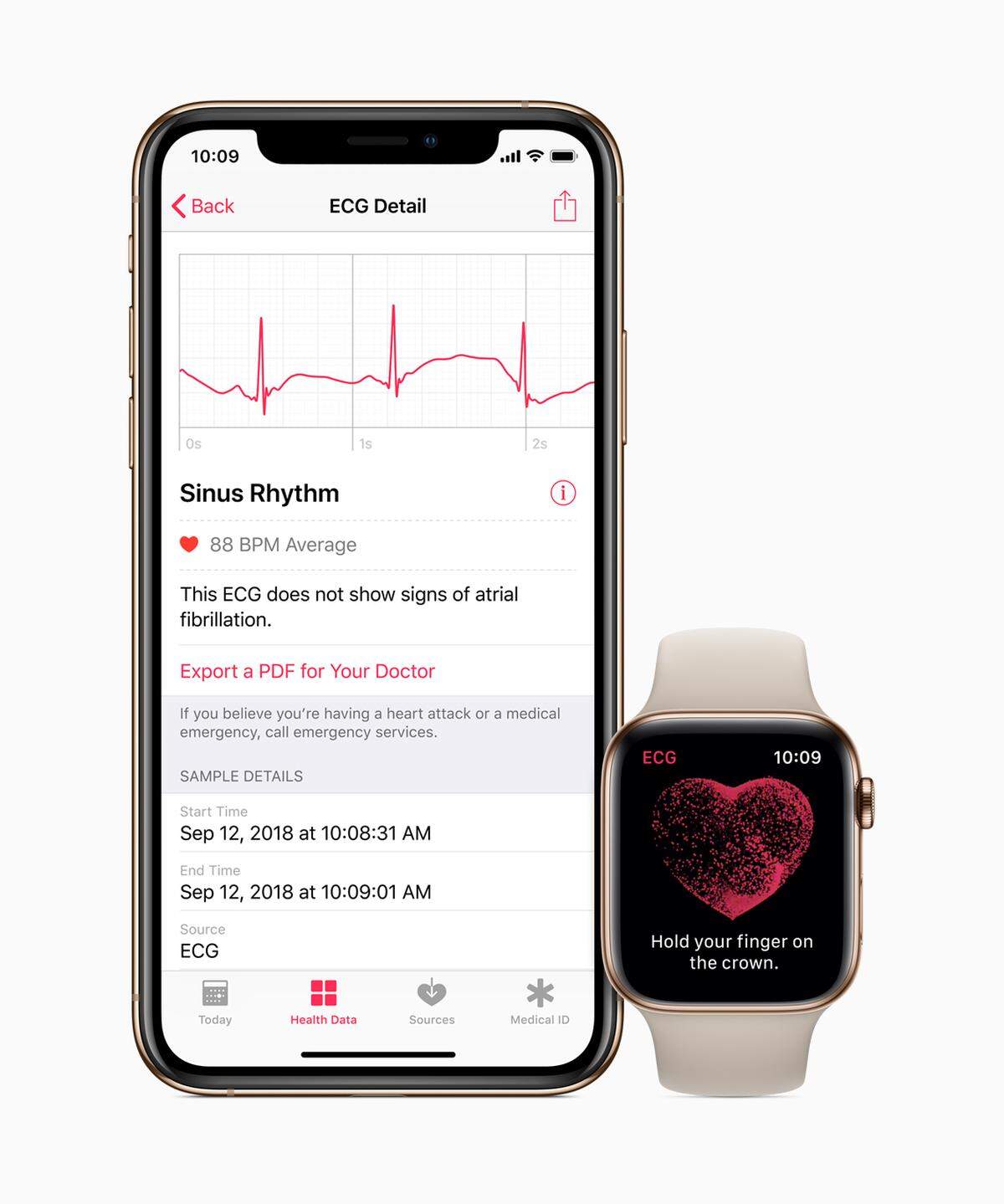 El estudio Apple Heart de más de 400,000 personas, fue abrumadoramente en usuarios más jóvenes de Apple Watch, sin condiciones previas del corazón. El estudio encontró que solo .52% de los participantes, o unos 2,000, tenían ritmos del corazón irregulares.