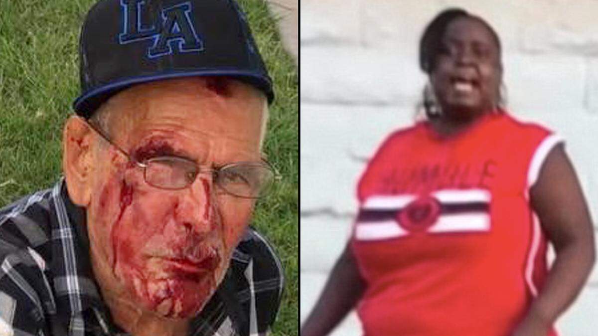 Combinación de fotografías de Rodolfo Rodríguez con la cara ensangrentada y de su agresora, identificada por la Policía como Laquisha Jones.