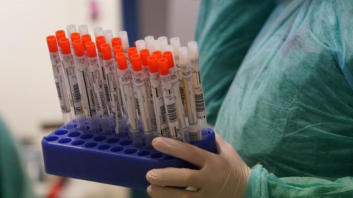 Did you have coronavirus without knowing? Scientists are developing tests to find out