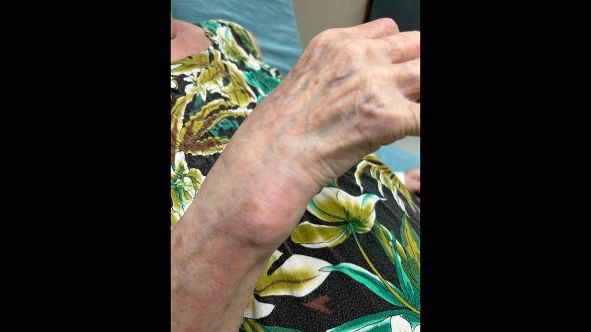 La mujer de 83 años sufrió lesiones en la muñeca cuando se negó a dar un bono a la sospechosa, según informó la Oficina del Sheriff del Condado de Brevard. Foto de la Oficina del Sheriff del Condado de Brevard.