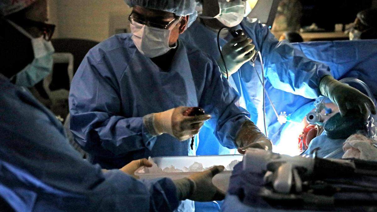 Foto de archivo del 17 de enero de 2018 que muestra al doctor Chintalapati Varma retirando el riñón de un paciente durante una cirugía en el Hospital Universitario SSM Health Saint Louis, en Missouri.