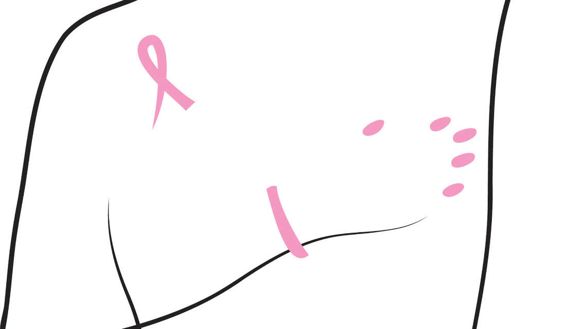 María Marín: Mi palabra más temida, “Cáncer” | Opinión