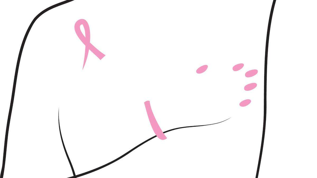 Si al igual que yo fuiste diagnosticado con esta enfermedad, convéncete de que el cáncer no es una sentencia de muerte, más bien es una prueba que nos hace más fuerte.