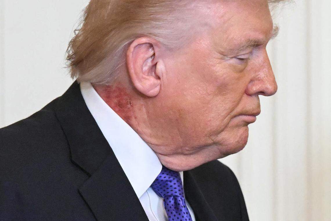 El presidente de Estados Unidos, Donald Trump, observa durante una ceremonia de la Medalla de Honor en el Salón Este de la Casa Blanca el 2 de marzo de 2026, en Washington, DC.