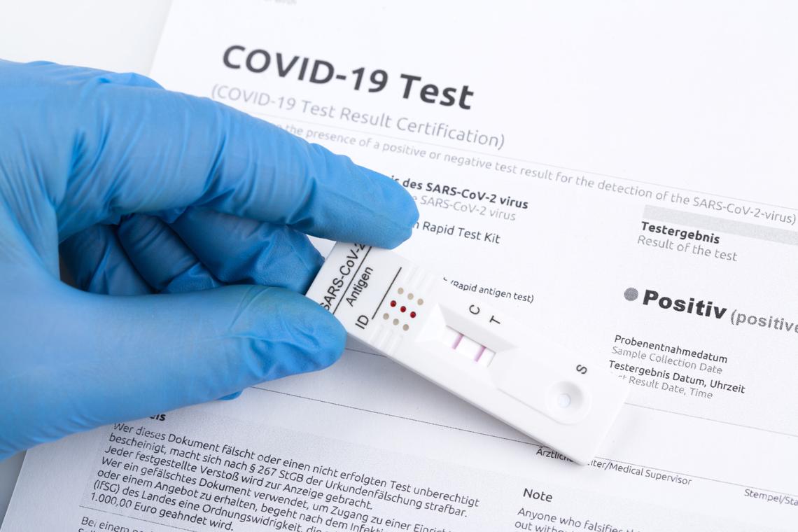 A positive test for COVID-19.