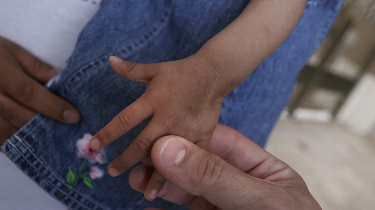 Los niños hispanos siguen siendo los que tienen la tasa más alta de no asegurados: 7.8 por ciento, en comparación con el 4.9 por ciento entre los blancos no hispanos y el 4.6 por ciento entre las personas de raza negra no hispanas.