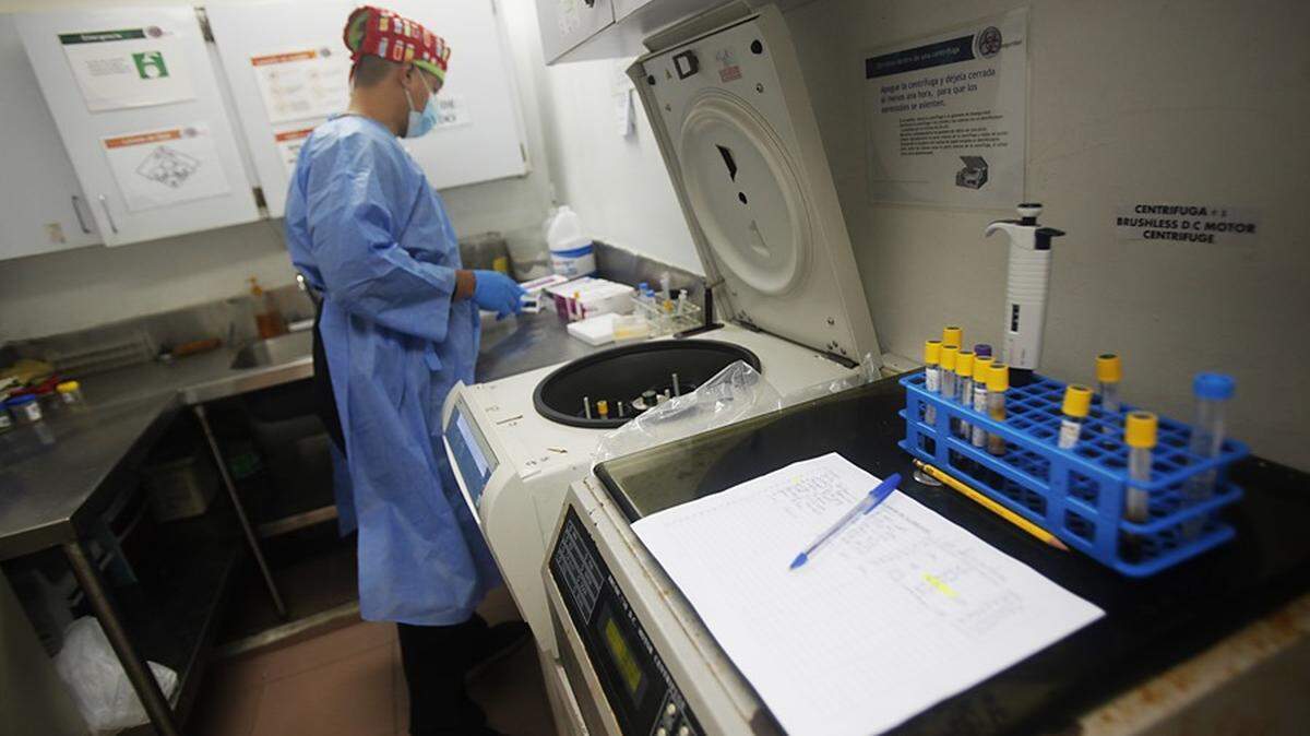 UN TRABAJADOR de la salud manipula muestras para un examen de VIH.