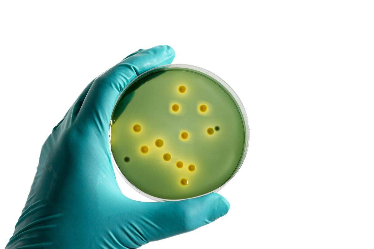 Primer plano de un cultivo de la bacteria Vibrio en el laboratorio.