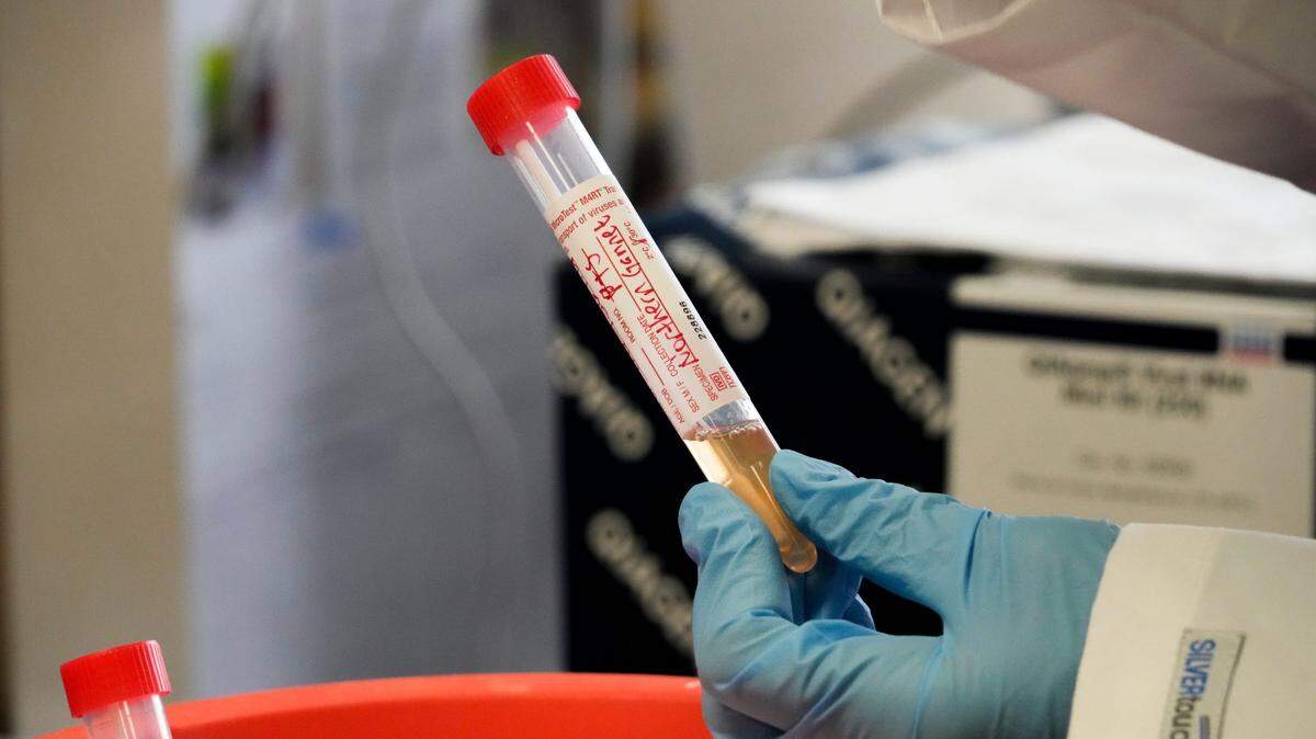 Estudiantes de secundaria de la ciudad de Nueva York que trabajan en un laboratorio de virología en Mount Sinai recolectan excrementos de aves en Central Park el 19 de abril de 2022. Están buscando patógenos como la gripe aviar y el paramixovirus aviar 1, un virus que solo afecta a las aves de corral.