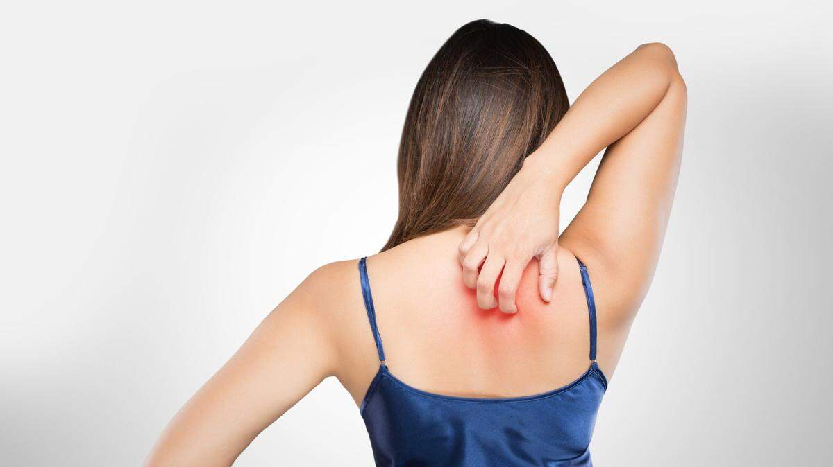 Woman scratching her itchy back with allergy rash, Concept with Healthcare And Medicine.
