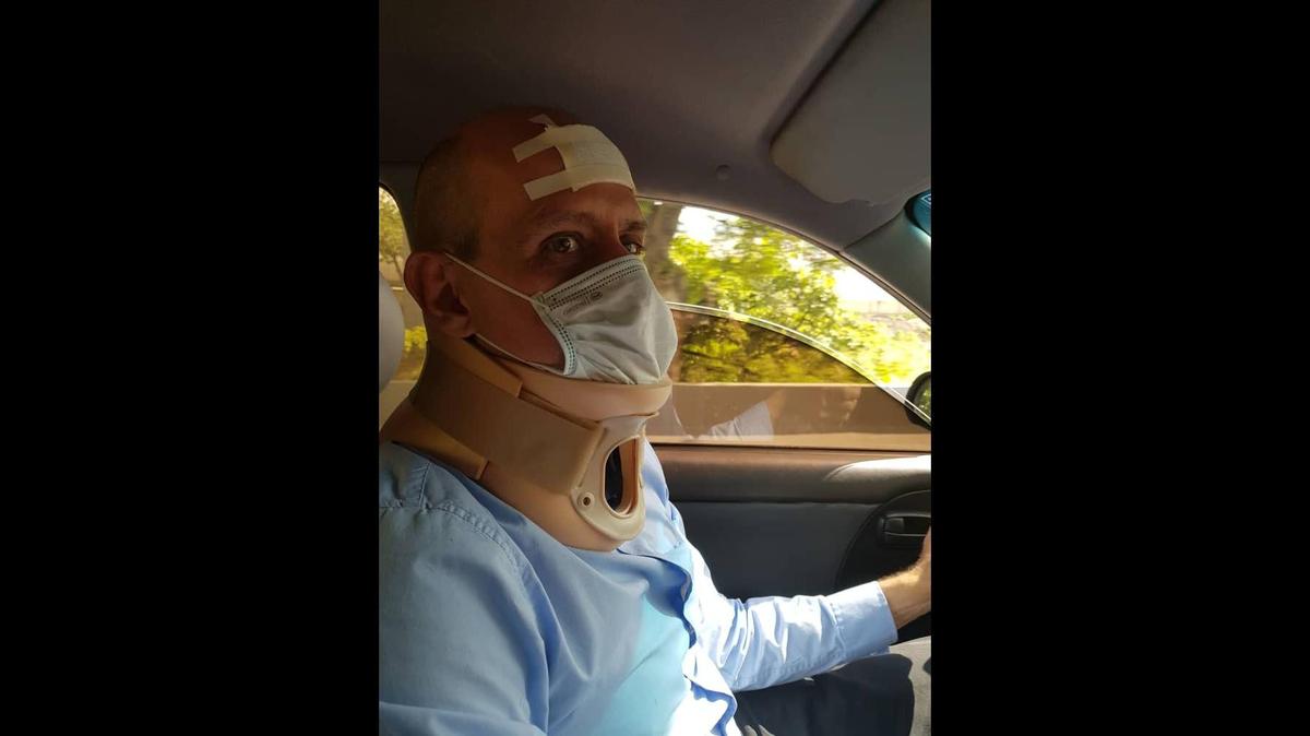 Omar Pérez después de ser agredido por los invasores de su propiedad. Después de ser expulsado de su edificio, Pérez no ha podido regresar al inmueble.