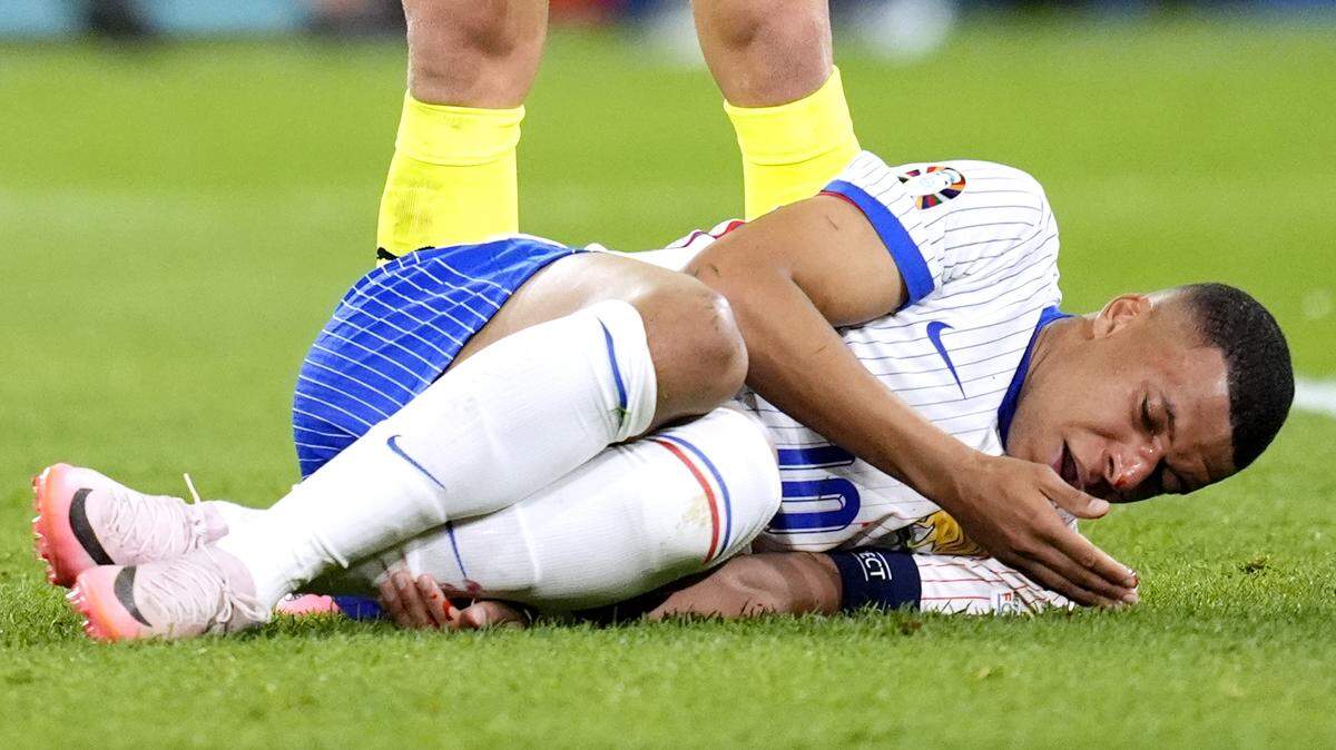 Tras un choque con el defensa rival Kevin Danso, Kylian Mbappé tuvo que abandonar el encuentro contra Austria el lunes y luego pasó exámenes radiológicos en un hospital que confirmaron una fractura nasal.